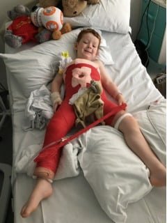 Harry, still smiling after surgery